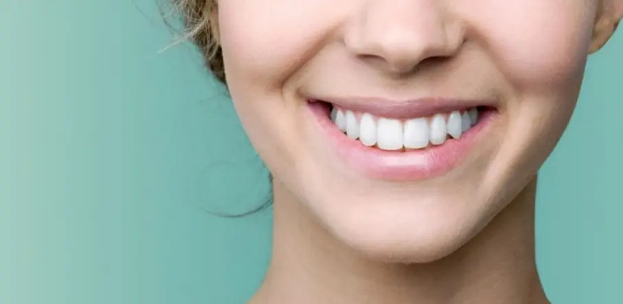 Clareamento dental valor 2023.